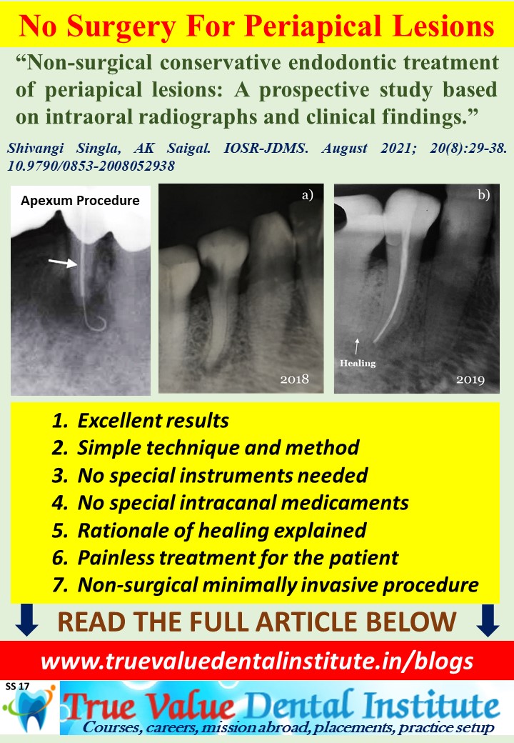 tooth periapical lesion